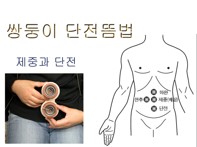 광명쑥뜸 이미지