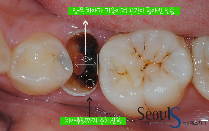 더블클릭을 하시면 이미지를 수정할 수 있습니다