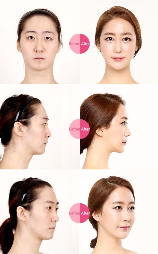 렛미인 이미지