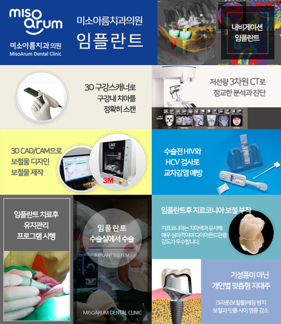 전주임플란트치과 빠진 치아를 방치할 경우 나타나는 문제점
