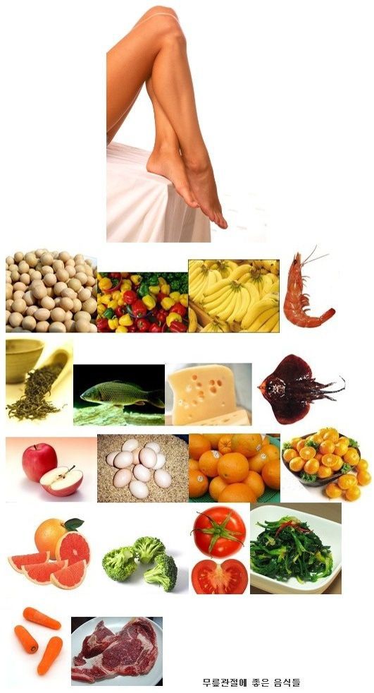 관절 정보-연골에 좋은 음식 5가지